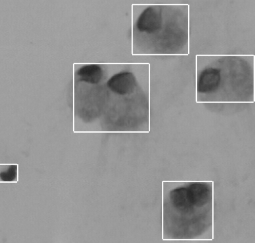 Cell detection with bounding boxes